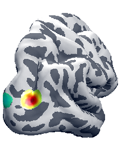 UC San Diego Receives $4.4M from NIMH for Brain Imaging Data “Gateway”